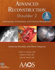 Advanced Reconstruction: Shoulder 2: Ebook without Multimedia