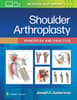 Shoulder Arthroplasty