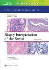 Biopsy Interpretation of the Breast: Print + eBook with Multimedia