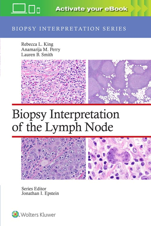 Biopsy Interpretation of the Lymph Node: Print + eBook with Multimedia