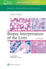 Biopsy Interpretation of the Liver