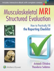 Musculoskeletal MRI Structured Evaluation