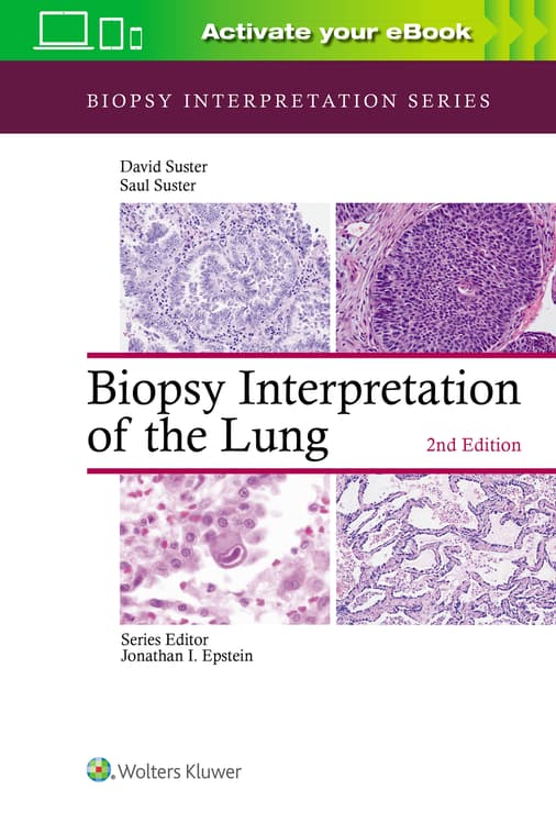 Biopsy Interpretation of the Lung