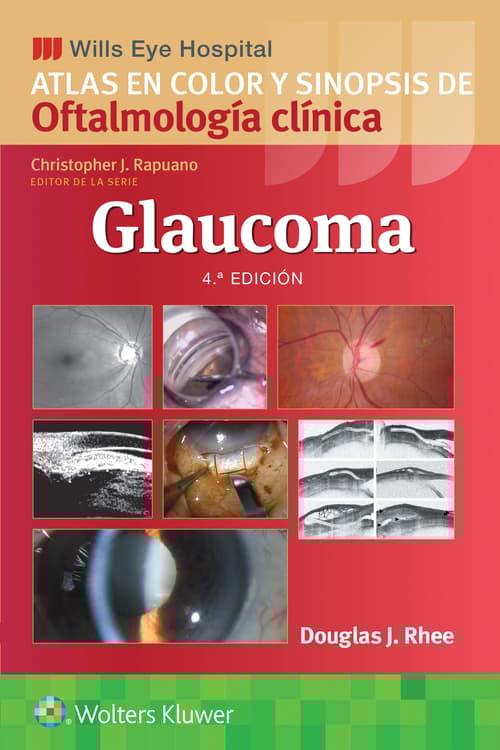 Wills Eye Hospital. Atlas en color y sinopsis de oftalmología clínica. Glaucoma
