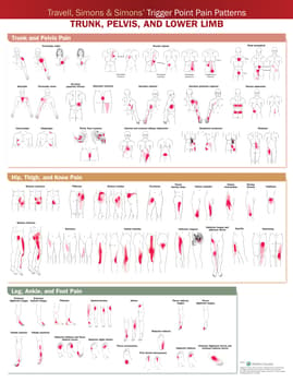 Travell, Simons & Simons’ Trigger Point Pain Patterns Wall Chart