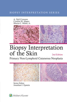 Biopsy Interpretation of the Skin