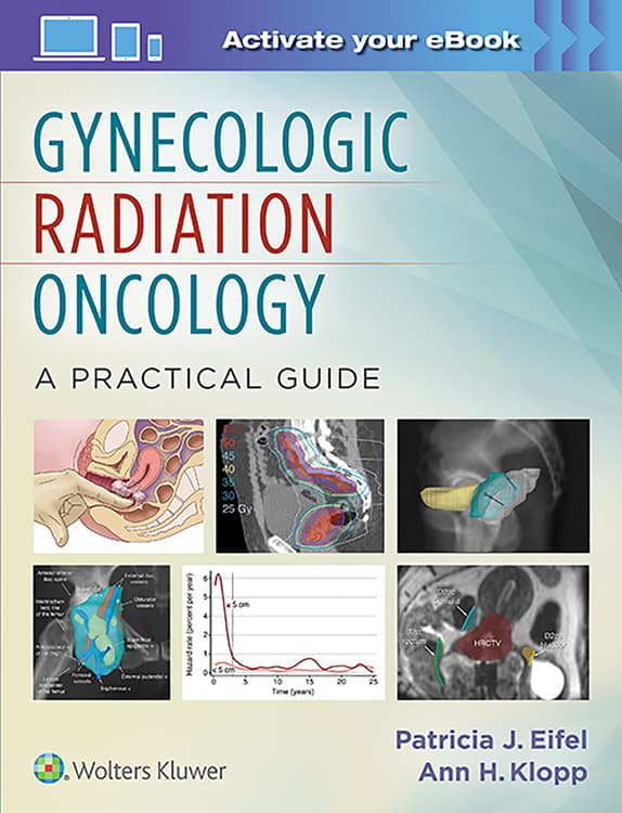 Gynecologic Radiation Oncology: A Practical Guide