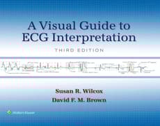A Visual Guide to ECG Interpretation: eBook with Multimedia