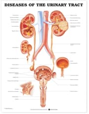 Diseases of the Urinary Tract Anatomical Chart