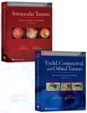 Shields: Intraocular Tumors 3e and Eyelid, Conjunctival, and Orbital Tumors 3e Package