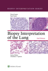 Biopsy Interpretation of the Lung
