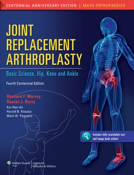 Joint Replacement Arthroplasty