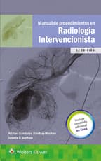 Manual de procedimientos en radiología intervencionista