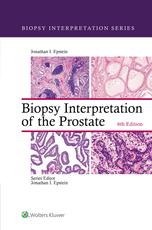 Biopsy Interpretation of the Prostate