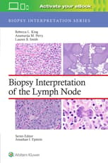 Biopsy Interpretation of the Lymph Node: Print + eBook with Multimedia