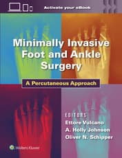 Minimally Invasive Foot and Ankle Surgery