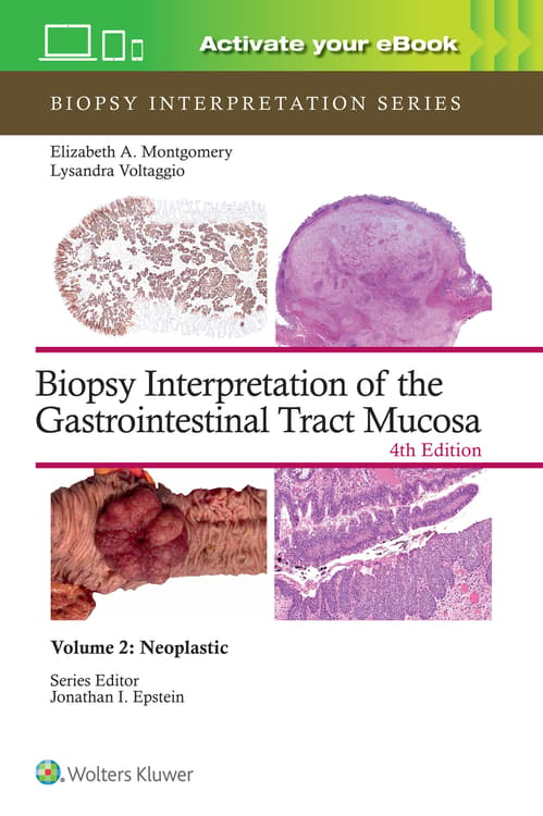 Biopsy Interpretation of the Gastrointestinal Tract Mucosa Volume 2