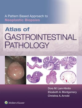 Atlas of Gastrointestinal Pathology: A Pattern Based Approach to Neoplastic Biopsies