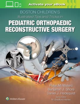 Boston Children's Illustrated Tips and Tricks in Pediatric Orthopaedic Reconstructive Surgery