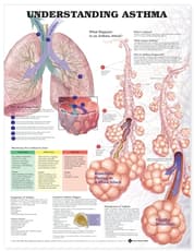 Understanding Asthma Anatomical Chart