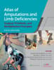 Atlas of Amputations and Limb Deficiencies