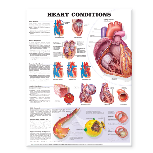Heart Conditions