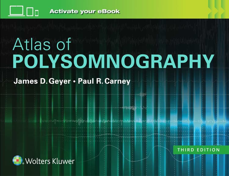 Atlas of Polysomnography