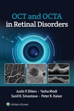 OCT and OCTA in Retinal Disorders