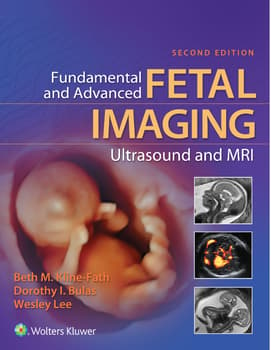 Fundamental and Advanced Fetal Imaging Ultrasound and MRI