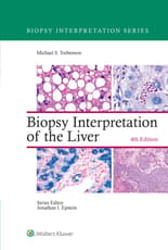 Biopsy Interpretation of the Liver