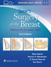 Spear's Surgery of the Breast