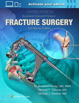 Harborview Illustrated Tips and Tricks in Fracture Surgery