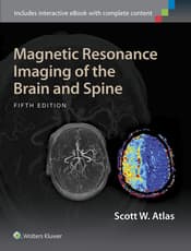 Magnetic Resonance Imaging of the Brain and Spine