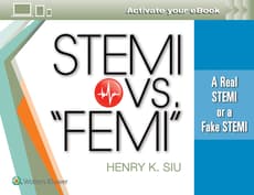 Stemi vs. Femi: The Real Deal STEMI or Fake Stemi