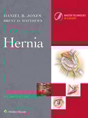 Master Techniques in Surgery: Hernia: eBook with Multimedia