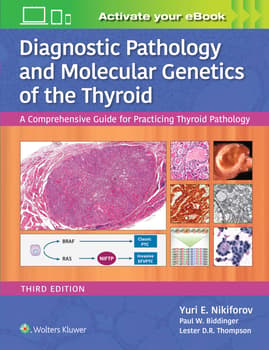 Diagnostic Pathology and Molecular Genetics of the Thyroid