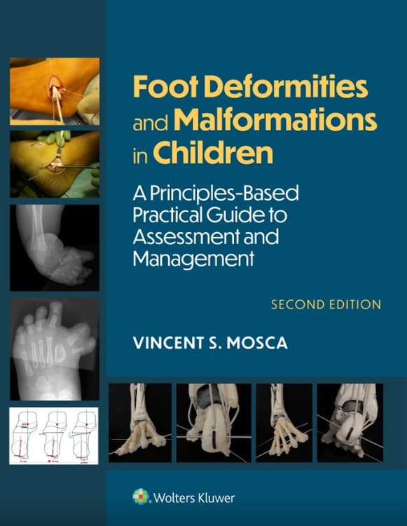 Foot Deformities and Malformations in Children