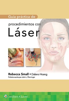 Guía práctica de procedimientos con láser