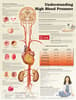 Understanding High Blood Pressure