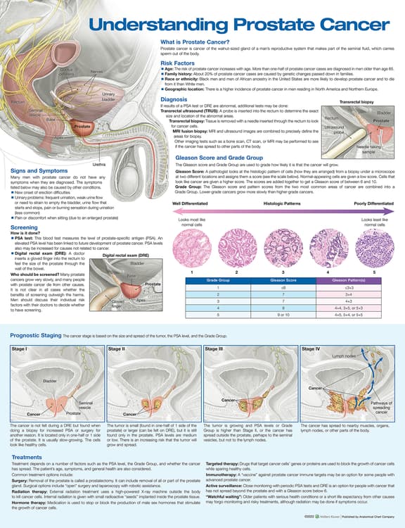 Understanding Prostate Cancer Anatomical Chart