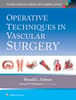 Operative Techniques in Vascular Surgery