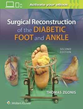 Surgical Reconstruction of the Diabetic Foot and Ankle