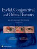Eyelid, Conjunctival, and Orbital Tumors: An Atlas and Textbook