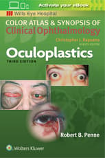 Oculoplastics