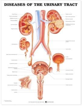 Diseases of the Urinary Tract Anatomical Chart