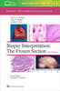 Biopsy Interpretation: The Frozen Section: Print + eBook with Multimedia