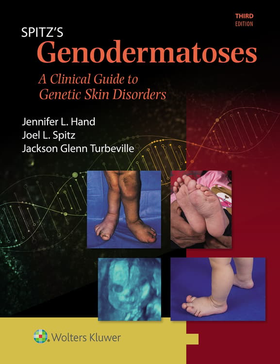 Spitz's Genodermatoses