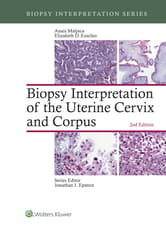 Biopsy Interpretation of the Uterine Cervix and Corpus