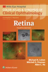 Retina