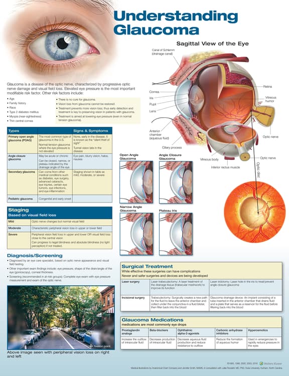 Understanding Glaucoma Anatomical Chart